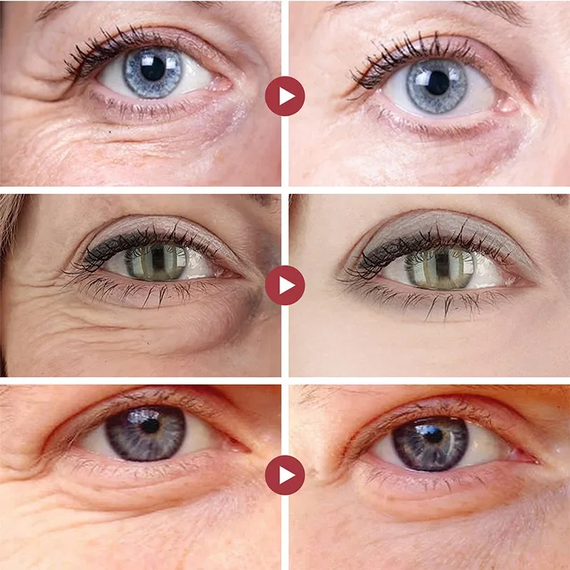 Wrinkle Remove Eyes Patches Fi - Eye Pad Collagen 评论和价格